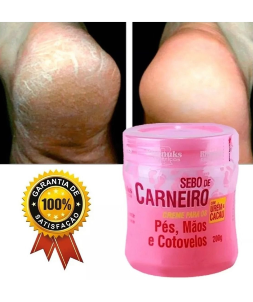 CREME PARA OS PÉS MÃOS E COTOVELOS RHENUKS